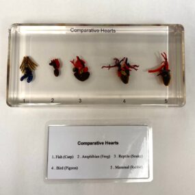 comparative hearts in resin